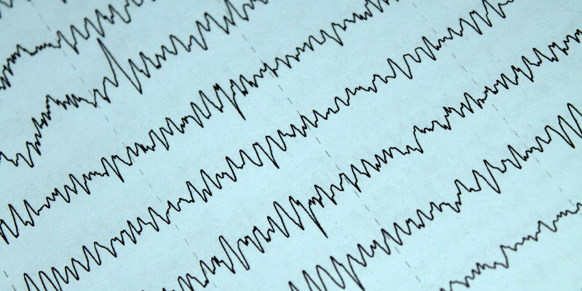 Zaps, Signals, and Stenosis