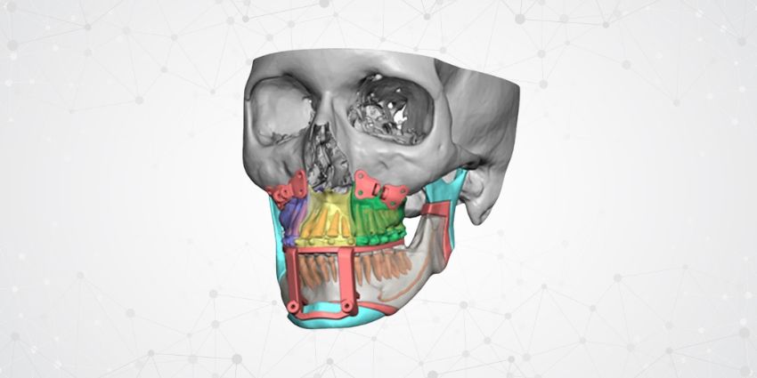 FDA Green Light: VSP® Orthopedics Just Got a Whole Lot More Useful