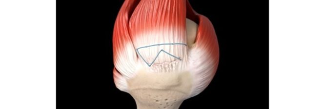 Smith+Nephew completes acquisition of Integrity Orthopaedics; establishes unrivalled portfolio for shoulder repair
