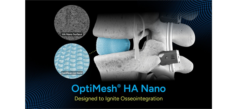 Spineology Launches OptiMesh® HA Nano