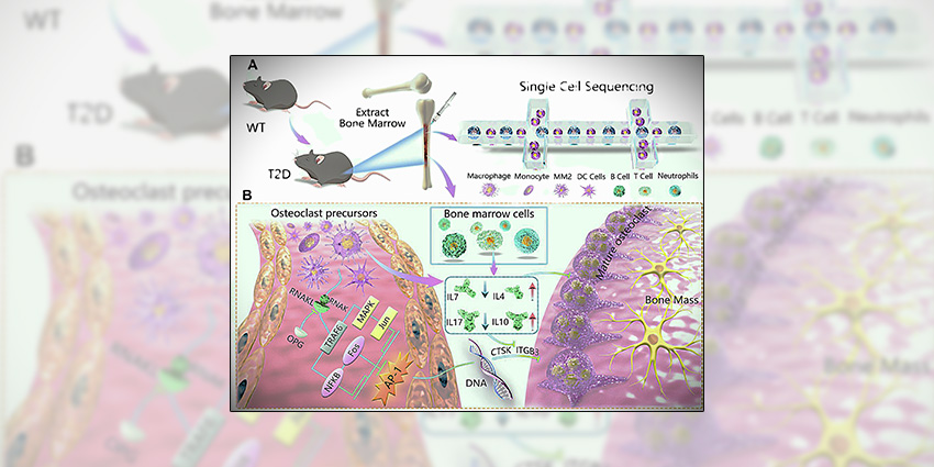Paging the Bone Whisperers: HSS’s Metabolic Fellowship Gets $495K