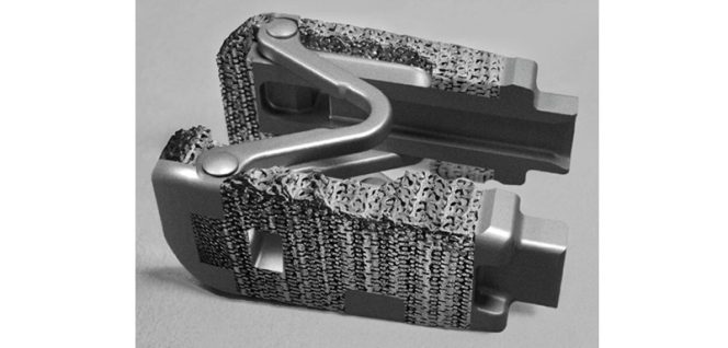 Spine Innovation Announces FDA 510(k) Clearance for LOGIC™ Titanium Expandable Interbody System