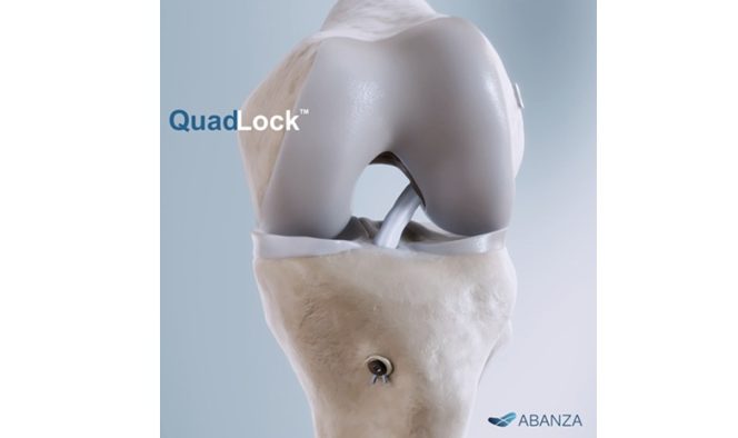 ABANZA Secures FDA 510(k) Clearance for QuadLock™ Fixation System for ACL Reconstruction