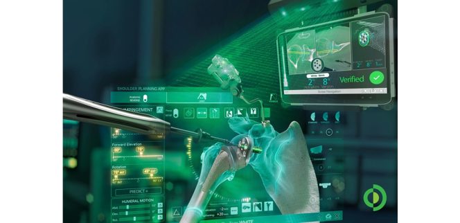 Advita Ortho Expands Navigation Platform with Next-Generation GPS Shoulder System