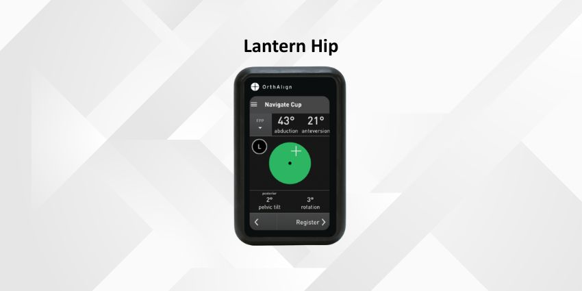 Lantern THA NAV now Posterior – BOTH Lateral and Supine