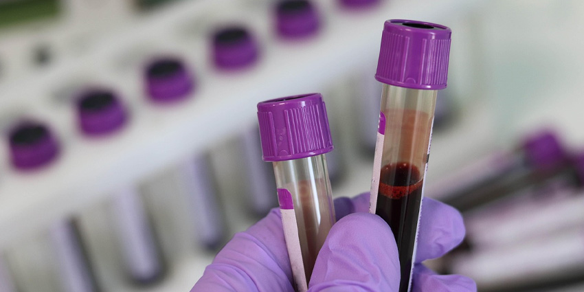 Prehab the Labs: When Albumin Outperforms Your Crystal Ball