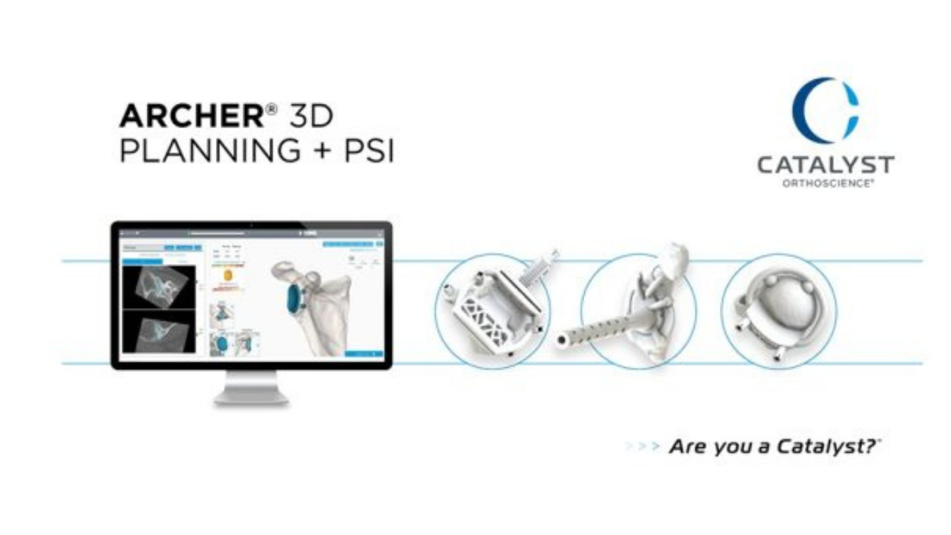 Catalyst OrthoScience Announces FDA 510(k) Clearance of Archer® Patient-Specific Instrumentation for Shoulder Arthroplasty