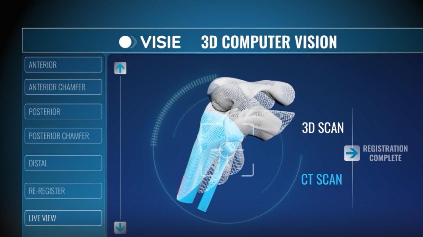 The Coming VISIE-Sparked 3D Vision Revolution