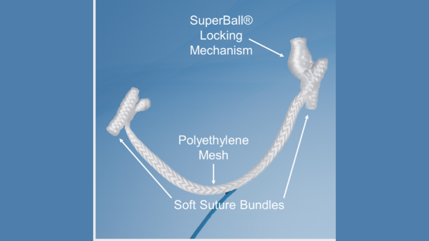 Suture Meets Superpowers: A New Chapter in Shoulder and Knee Repair