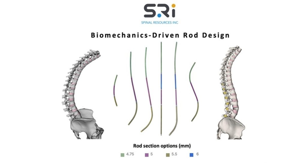 First-of-its-kind Universal Clearance Establishes Maximum Regulatory Access to the Bezier Parametric Curve Spinal Rod System for Patients and Surgeons