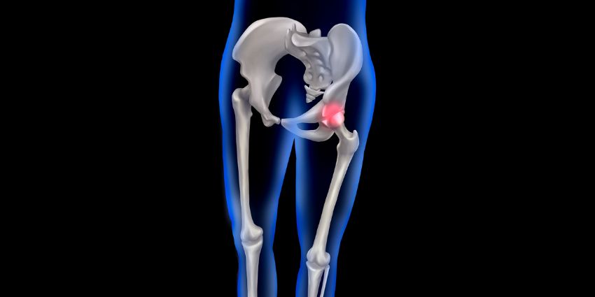 Autograft vs Allograft: Choose Your Graft, Not Your Anxiety