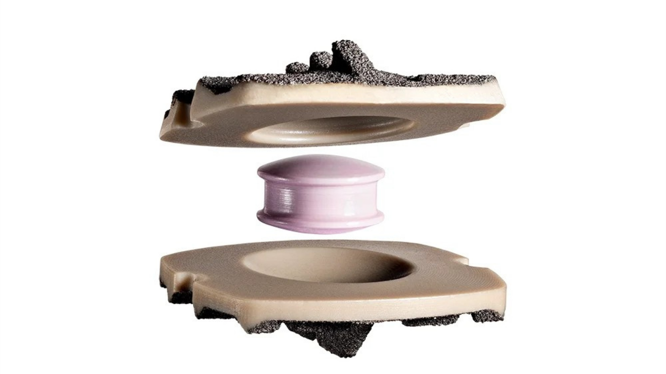 The PEEK-on-Ceramic Disc That Refuses to Fuse