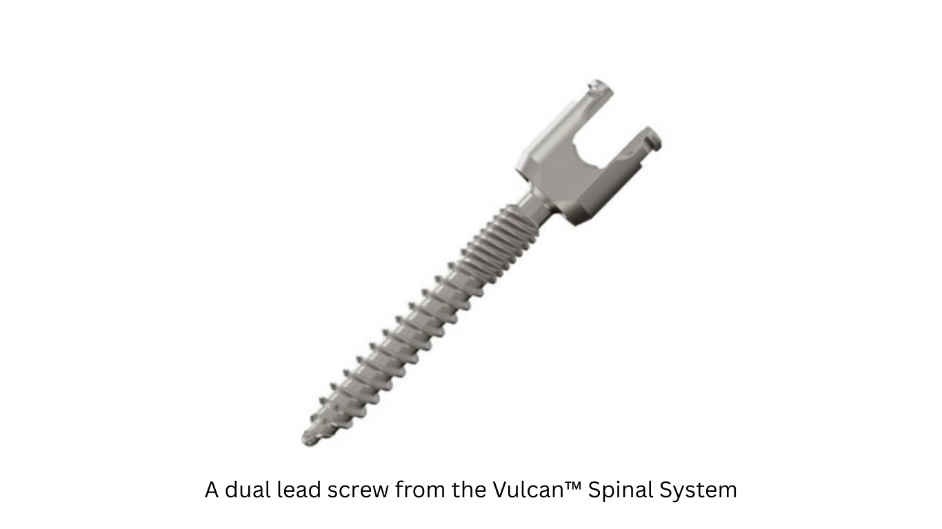 VB Spine Announces Successful First Clinical Cases of Vulcan™ Spinal System