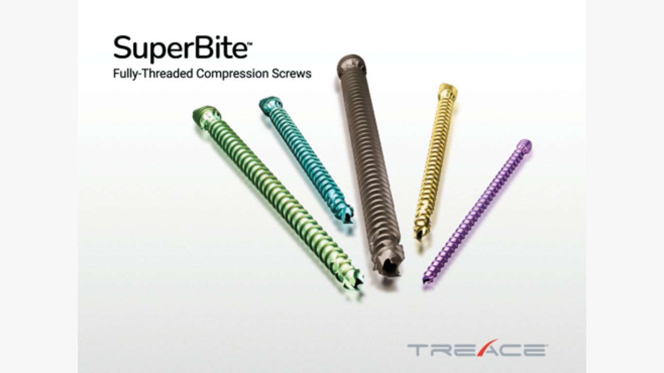 Treace Announces First Surgical Cases with the SuperBite™ Compression Screw System