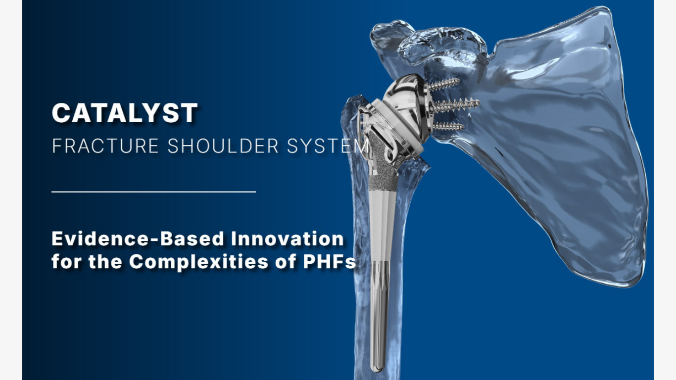 Catalyst OrthoScience Demonstrates Leadership in Procedural Efficiency with Addition of Fracture to Its Single-Tray Portfolio