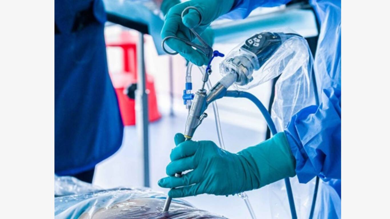 joimax® Celebrates 25 Years of Advancing Endoscopic Spine Surgery