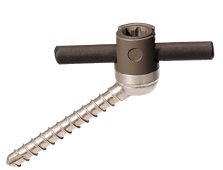CarboFix Spine Announces FDA Clearance of CarboClear® Hybrid Posterior Cervical Screw System