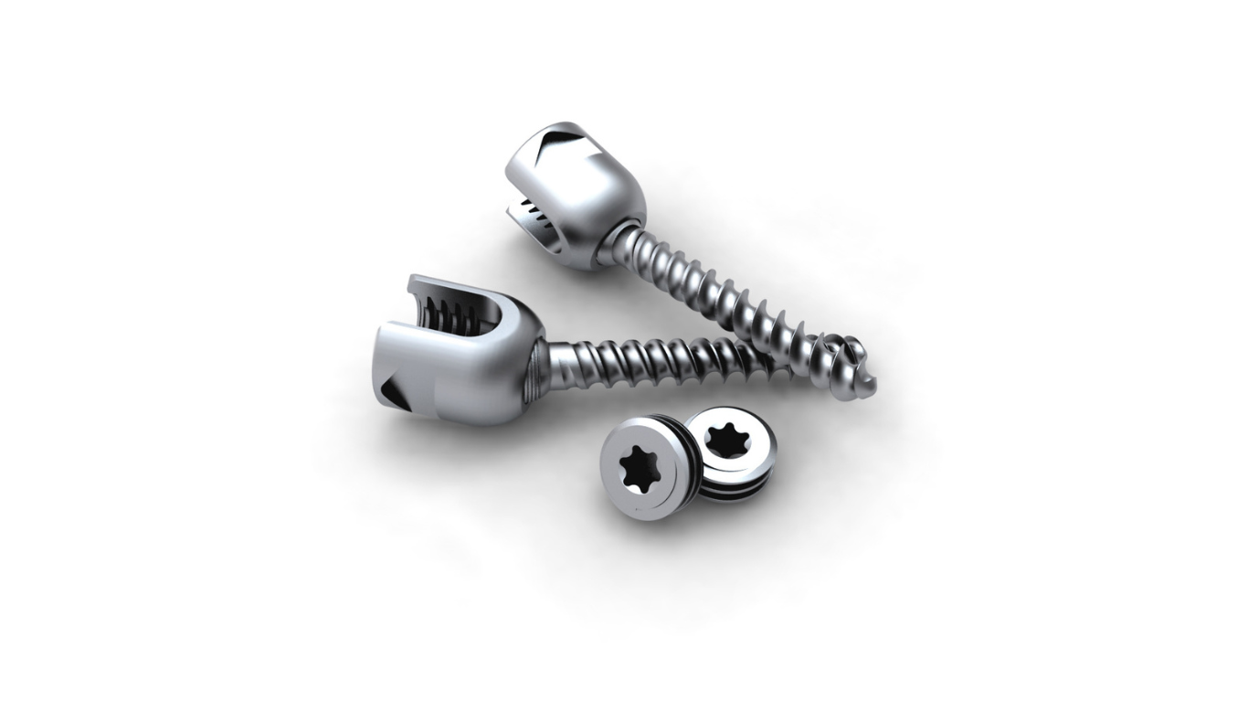 Pedicle Screws, Bone Quality, and the Great Anchorage Debate