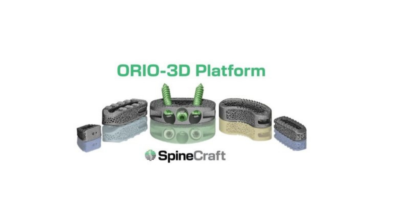 SpineCraft Announces U.S. FDA 510(k) Clearance of Comprehensive ORIO-3D Trabecular Interbody Platform