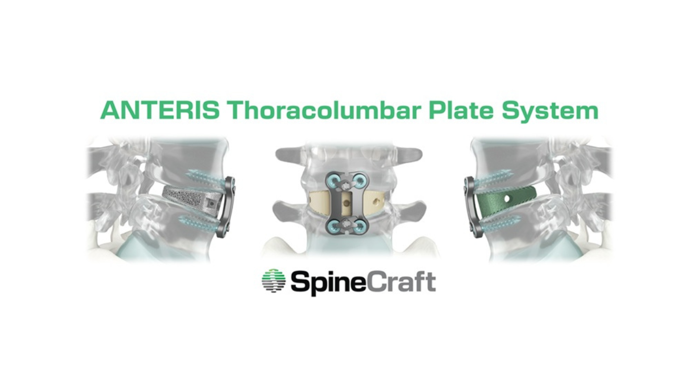 SpineCraft Announces U.S. FDA 510(k) Clearance of ANTERIS Thoracolumbar Plate System