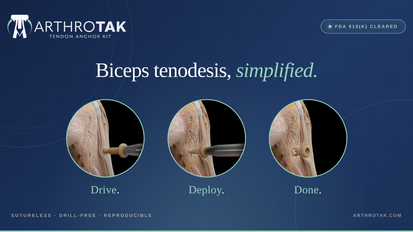 ArthroTAK Receives FDA 510(k) Clearance for the ArthroTAK™ Tendon Anchor Kit, a Sutureless, Soft-Tissue Fixation System for Biceps Tenodesis